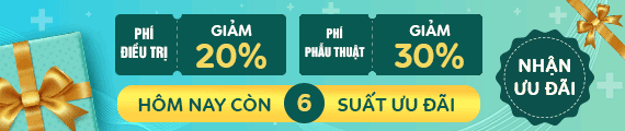 Tư vấn chi phí