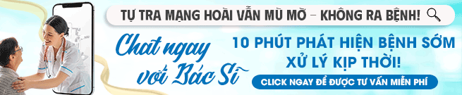 Tư vấn chi phí